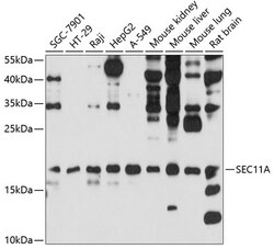 Invitrogen SEC11A Polyclonal Antibody 100 &mu;L; Unconjugated:Antibodies,