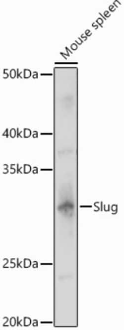 Invitrogen SLUG Polyclonal Antibody 100 &mu;L; Unconjugated:Antibodies,