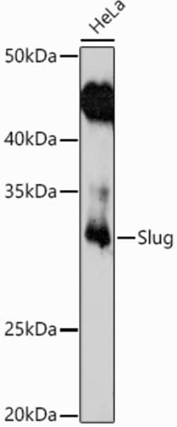Invitrogen SLUG Polyclonal Antibody 100 &mu;L; Unconjugated:Antibodies,