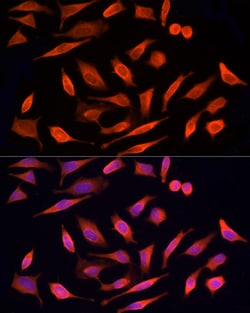 Invitrogen MST3 Polyclonal Antibody 100 &mu;L; Unconjugated:Antibodies,