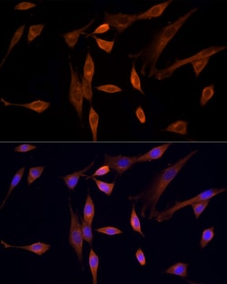 Invitrogen MST3 Polyclonal Antibody 100 &mu;L; Unconjugated:Antibodies,