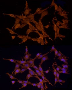 Invitrogen MST3 Polyclonal Antibody 100 &mu;L; Unconjugated:Antibodies,