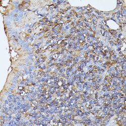 Invitrogen MST3 Polyclonal Antibody 100 &mu;L; Unconjugated:Antibodies,