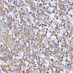 Invitrogen MST3 Polyclonal Antibody 100 &mu;L; Unconjugated:Antibodies,