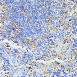 Invitrogen MST3 Polyclonal Antibody 100 &mu;L; Unconjugated:Antibodies,