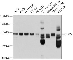 Invitrogen MST3 Polyclonal Antibody 100 &mu;L; Unconjugated:Antibodies,