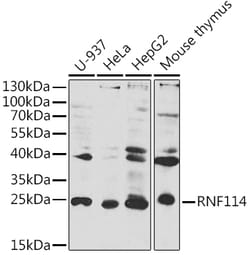 Invitrogen ZNF313 Polyclonal Antibody 100 &mu;L; Unconjugated:Antibodies,