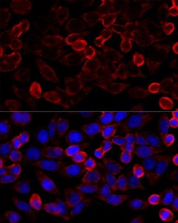 Invitrogen HDAC6 Polyclonal Antibody 100 μL; Unconjugated:Antibodies,