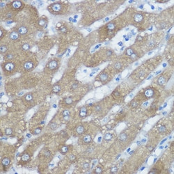 Invitrogen HDAC6 Polyclonal Antibody 100 μL; Unconjugated:Antibodies,