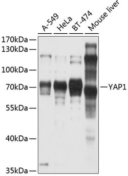 Invitrogen YAP1 Polyclonal Antibody 100 &mu;L; Unconjugated:Antibodies,