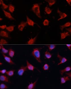 Invitrogen Caspase 8 Polyclonal Antibody 100 &mu;L; Unconjugated:Antibodies,
