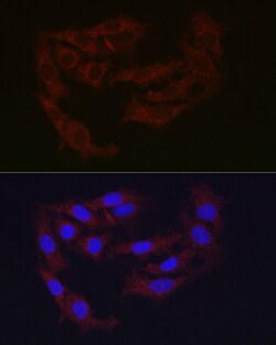 Invitrogen Ferritin Heavy Chain Polyclonal Antibody 100 &mu;L; Unconjugated:Antibodies,