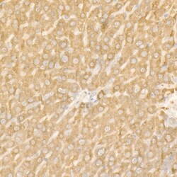 Invitrogen Ferritin Heavy Chain Polyclonal Antibody 100 &mu;L; Unconjugated:Antibodies,