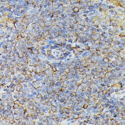 Invitrogen JAK2 Polyclonal Antibody 100 &mu;L; Unconjugated:Antibodies,