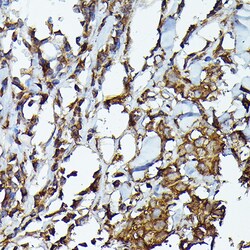 Invitrogen JAK2 Polyclonal Antibody 100 &mu;L; Unconjugated:Antibodies,