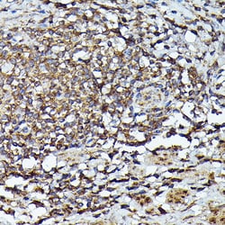 Invitrogen JAK2 Polyclonal Antibody 100 &mu;L; Unconjugated:Antibodies,