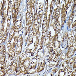Invitrogen JAK2 Polyclonal Antibody 100 &mu;L; Unconjugated:Antibodies,