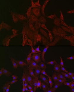 Invitrogen PAK4 Polyclonal Antibody 100 &mu;L; Unconjugated:Antibodies,