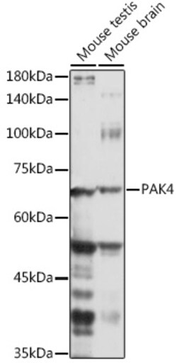 Invitrogen PAK4 Polyclonal Antibody 100 &mu;L; Unconjugated:Antibodies,