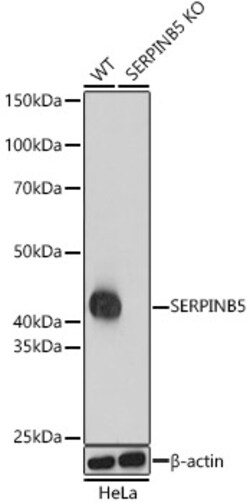 Invitrogen Maspin Polyclonal Antibody 100 μL; Unconjugated:Antibodies,