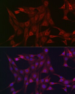 Invitrogen STAT3 Polyclonal Antibody 100 &mu;L | Buy Online | Invitrogen&trade; | Fisher Scientific