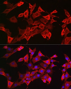Invitrogen STAT3 Polyclonal Antibody 100 &mu;L | Buy Online | Invitrogen&trade; | Fisher Scientific