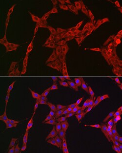 Invitrogen STAT3 Polyclonal Antibody 100 &mu;L | Buy Online | Invitrogen&trade; | Fisher Scientific