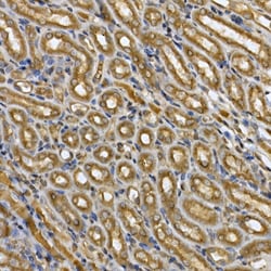 Invitrogen STAT3 Polyclonal Antibody 100 &mu;L | Buy Online | Invitrogen&trade; | Fisher Scientific