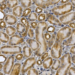 Invitrogen STAT3 Polyclonal Antibody 100 &mu;L | Buy Online | Invitrogen&trade; | Fisher Scientific