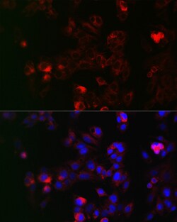 Invitrogen NOX1 Polyclonal Antibody 100 &mu;L; Unconjugated:Antibodies,