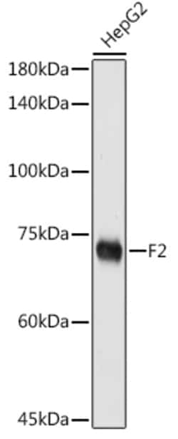 Invitrogen Prothrombin Polyclonal Antibody 100 &mu;L; Unconjugated:Antibodies,