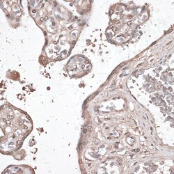 Invitrogen MEF2C Polyclonal Antibody 100 &mu;L; Unconjugated:Antibodies,