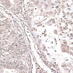 Invitrogen MEF2C Polyclonal Antibody 100 &mu;L; Unconjugated:Antibodies,