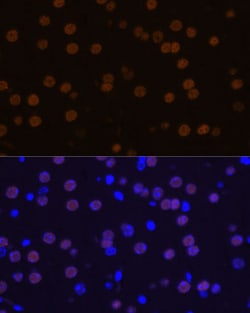 Invitrogen MEF2C Polyclonal Antibody 100 &mu;L; Unconjugated:Antibodies,