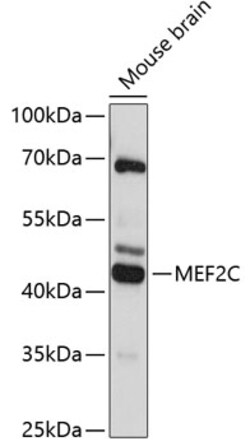 Invitrogen MEF2C Polyclonal Antibody 100 &mu;L; Unconjugated:Antibodies,