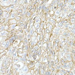 Invitrogen JAM-A (CD321) Polyclonal Antibody 100 &mu;L; Unconjugated:Antibodies,