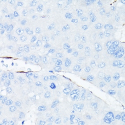 Invitrogen VE-cadherin Polyclonal Antibody 100 &mu;L; Unconjugated:Antibodies,