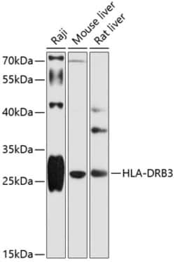 Invitrogen HLA-DRB3 Polyclonal Antibody 100 &mu;L | Buy Online | Invitrogen&trade; | Fisher Scientific