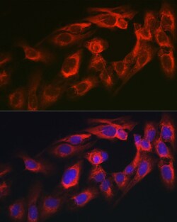 Invitrogen MYO10 Polyclonal Antibody 100 &mu;L; Unconjugated:Antibodies,