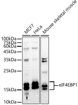 Invitrogen 4EBP1 Polyclonal Antibody 100 μL; Unconjugated:Antibodies,