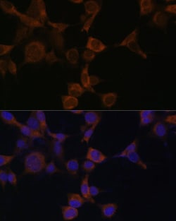 Invitrogen AMPK beta-1 Polyclonal Antibody 100 μL; Unconjugated:Antibodies,