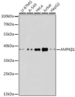 Invitrogen AMPK beta-1 Polyclonal Antibody 100 μL; Unconjugated:Antibodies,
