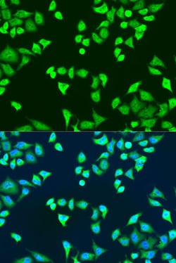 Invitrogen SMN2 Polyclonal Antibody 100 &mu;L; Unconjugated:Antibodies,