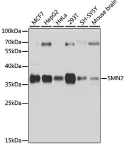 Invitrogen SMN2 Polyclonal Antibody 100 &mu;L; Unconjugated:Antibodies,