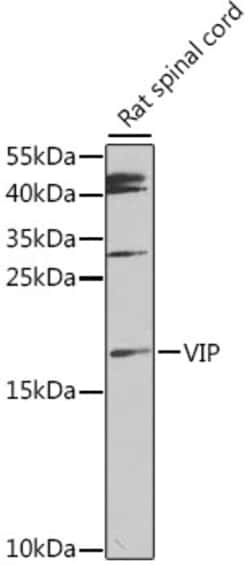Invitrogen VIP Polyclonal Antibody 100 &mu;L; Unconjugated:Antibodies,