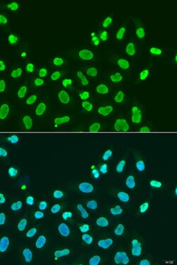 Invitrogen HP1 alpha Polyclonal Antibody 100 &mu;L; Unconjugated:Antibodies,