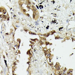 Invitrogen HSP70 Polyclonal Antibody 100 &mu;L; Unconjugated:Antibodies,