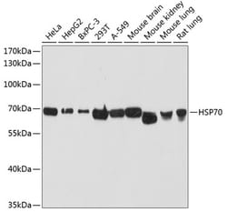 Invitrogen HSP70 Polyclonal Antibody 100 &mu;L; Unconjugated:Antibodies,