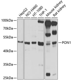 Invitrogen PON1 Polyclonal Antibody 100 &mu;L; Unconjugated:Antibodies,