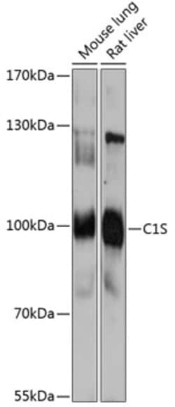 Invitrogen C1S Polyclonal Antibody 100 &mu;L; Unconjugated:Antibodies,